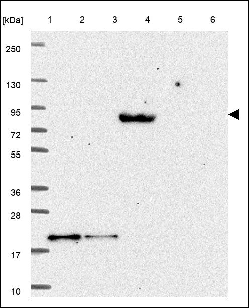 Lane 1: Marker [kDa] 250,130,95,72,55,36,28,17,10 Lane 2: RT4 Lane 3: U-251 MG Lane 4: Human Plasma Lane 5: Liver Lane 6: Tonsil