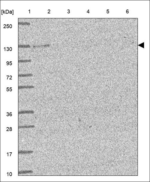Lane 1: Marker [kDa] 250,130,95,72,55,36,28,17,10 Lane 2: RT4 Lane 3: U-251 MG Lane 4: Human Plasma Lane 5: Liver Lane 6: Tonsil