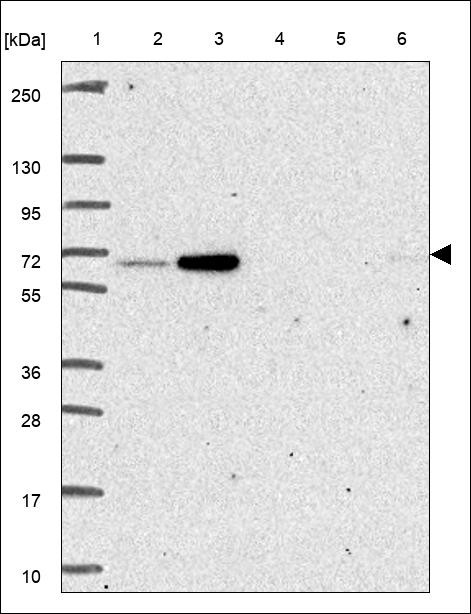 Lane 1: Marker [kDa] 250,130,95,72,55,36,28,17,10 Lane 2: RT4 Lane 3: U-251 MG Lane 4: Human Plasma Lane 5: Liver Lane 6: Tonsil