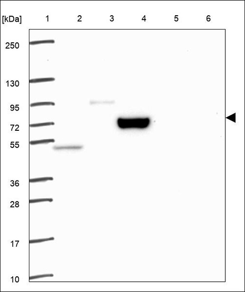 Lane 1: Marker [kDa] 250,130,95,72,55,36,28,17,10 Lane 2: RT4 Lane 3: U-251 MG Lane 4: Human Plasma Lane 5: Liver Lane 6: Tonsil