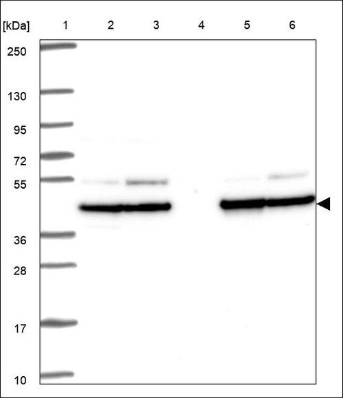 Lane 1: Marker [kDa] 250,130,95,72,55,36,28,17,10 Lane 2: RT4 Lane 3: U-251 MG Lane 4: Human Plasma Lane 5: Liver Lane 6: Tonsil