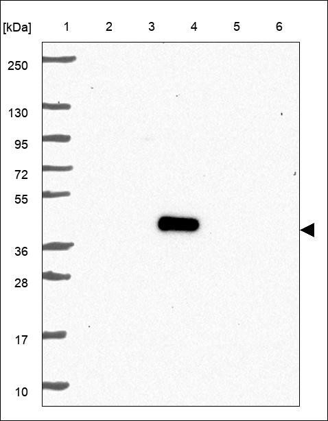 Lane 1: Marker [kDa] 250,130,95,72,55,36,28,17,10 Lane 2: RT4 Lane 3: U-251 MG Lane 4: Human Plasma Lane 5: Liver Lane 6: Tonsil