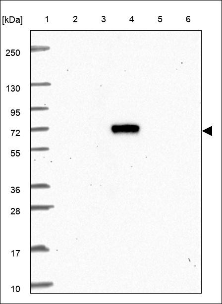 Lane 1: Marker [kDa] 250,130,95,72,55,36,28,17,10 Lane 2: RT4 Lane 3: U-251 MG Lane 4: Human Plasma Lane 5: Liver Lane 6: Tonsil