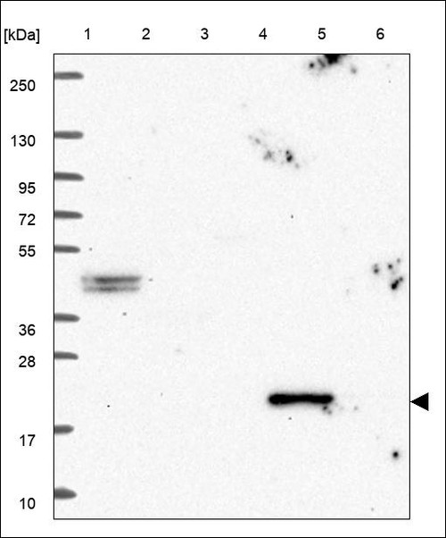 Lane 1: Marker [kDa] 250,130,95,72,55,36,28,17,10 Lane 2: RT4 Lane 3: U-251 MG Lane 4: Human Plasma Lane 5: Liver Lane 6: Tonsil
