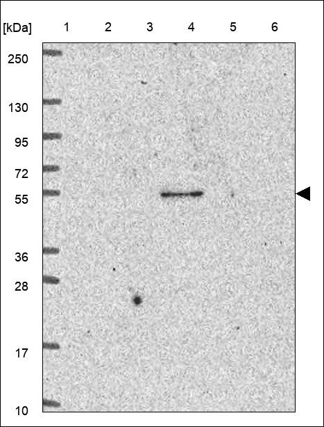 Lane 1: Marker [kDa] 250,130,95,72,55,36,28,17,10 Lane 2: RT4 Lane 3: U-251 MG Lane 4: Human Plasma Lane 5: Liver Lane 6: Tonsil