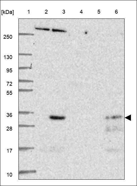 Lane 1: Marker [kDa] 250,130,95,72,55,36,28,17,10 Lane 2: RT4 Lane 3: U-251 MG Lane 4: Human Plasma Lane 5: Liver Lane 6: Tonsil