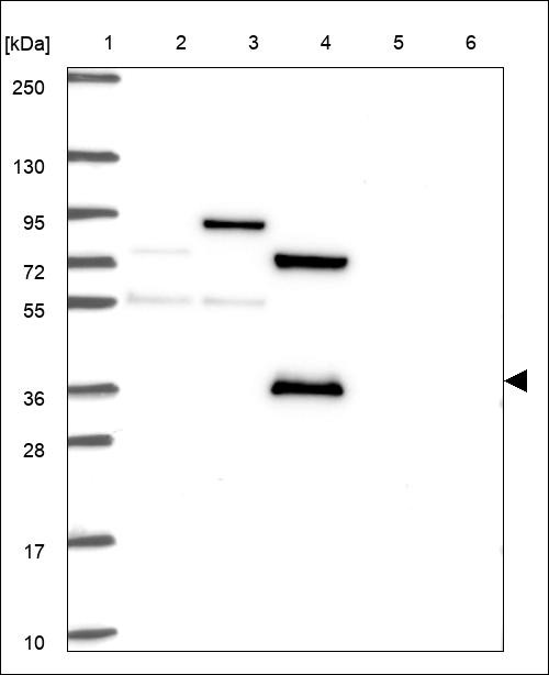 Lane 1: Marker [kDa] 250,130,95,72,55,36,28,17,10 Lane 2: RT4 Lane 3: U-251 MG Lane 4: Human Plasma Lane 5: Liver Lane 6: Tonsil
