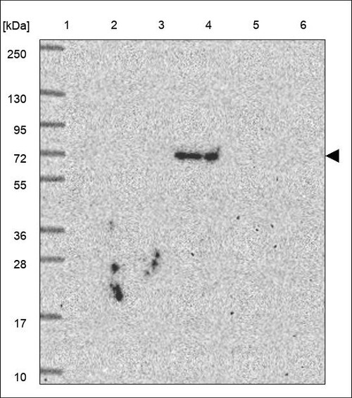 Lane 1: Marker [kDa] 250,130,95,72,55,36,28,17,10 Lane 2: RT4 Lane 3: U-251 MG Lane 4: Human Plasma Lane 5: Liver Lane 6: Tonsil