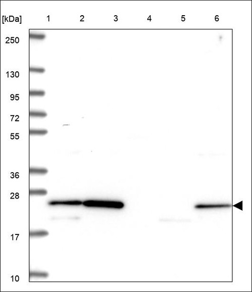 Lane 1: Marker [kDa] 250,130,95,72,55,36,28,17,10 Lane 2: RT4 Lane 3: U-251 MG Lane 4: Human Plasma Lane 5: Liver Lane 6: Tonsil