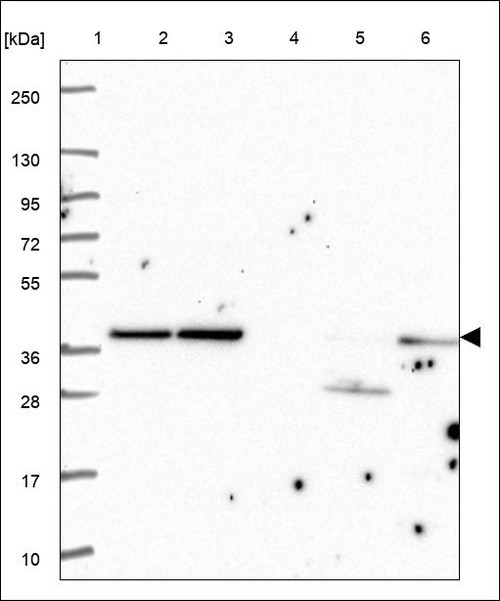 Lane 1: Marker [kDa] 250,130,95,72,55,36,28,17,10 Lane 2: RT4 Lane 3: U-251 MG Lane 4: Human Plasma Lane 5: Liver Lane 6: Tonsil