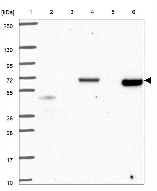 Lane 1: Marker [kDa] 250,130,95,72,55,36,28,17,10 Lane 2: RT4 Lane 3: U-251 MG Lane 4: Human Plasma Lane 5: Liver Lane 6: Tonsil