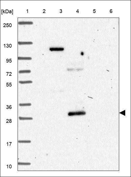 Lane 1: Marker [kDa] 250,130,95,72,55,36,28,17,10 Lane 2: RT4 Lane 3: U-251 MG Lane 4: Human Plasma Lane 5: Liver Lane 6: Tonsil