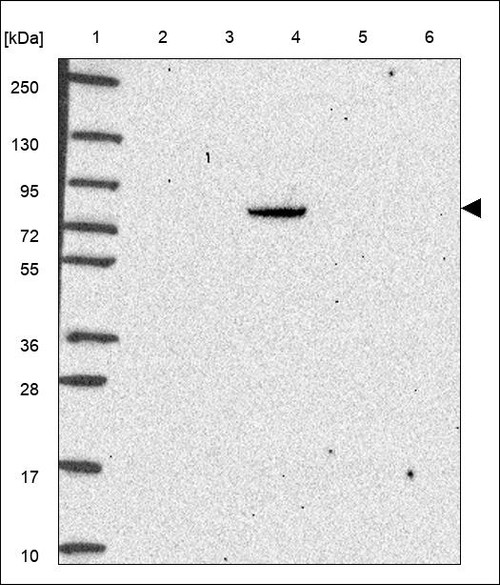 Lane 1: Marker [kDa] 250,130,95,72,55,36,28,17,10 Lane 2: RT4 Lane 3: U-251 MG Lane 4: Human Plasma Lane 5: Liver Lane 6: Tonsil