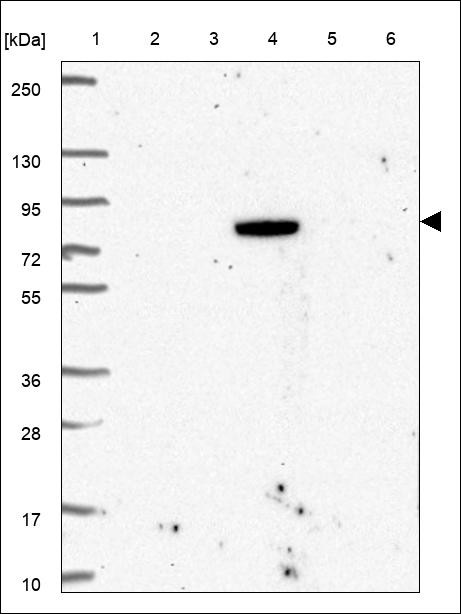 Lane 1: Marker [kDa] 250,130,95,72,55,36,28,17,10 Lane 2: RT4 Lane 3: U-251 MG Lane 4: Human Plasma Lane 5: Liver Lane 6: Tonsil