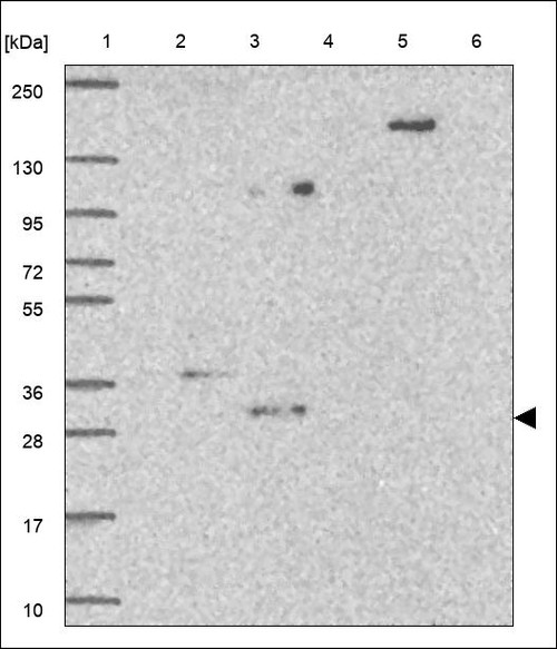 Lane 1: Marker [kDa] 250,130,95,72,55,36,28,17,10 Lane 2: RT4 Lane 3: U-251 MG Lane 4: Human Plasma Lane 5: Liver Lane 6: Tonsil