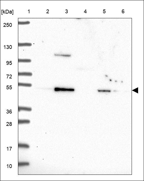 Lane 1: Marker [kDa] 250,130,95,72,55,36,28,17,10 Lane 2: RT4 Lane 3: U-251 MG Lane 4: Human Plasma Lane 5: Liver Lane 6: Tonsil