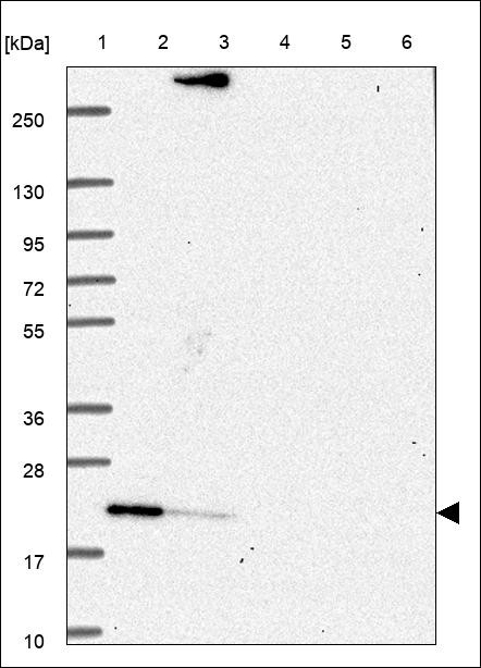Lane 1: Marker [kDa] 250,130,95,72,55,36,28,17,10 Lane 2: RT4 Lane 3: U-251 MG Lane 4: Human Plasma Lane 5: Liver Lane 6: Tonsil