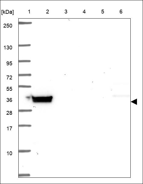 Lane 1: Marker [kDa] 250,130,95,72,55,36,28,17,10 Lane 2: RT4 Lane 3: U-251 MG Lane 4: Human Plasma Lane 5: Liver Lane 6: Tonsil