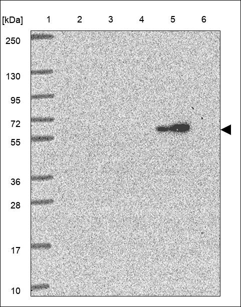 Lane 1: Marker [kDa] 250,130,95,72,55,36,28,17,10 Lane 2: RT4 Lane 3: U-251 MG Lane 4: Human Plasma Lane 5: Liver Lane 6: Tonsil