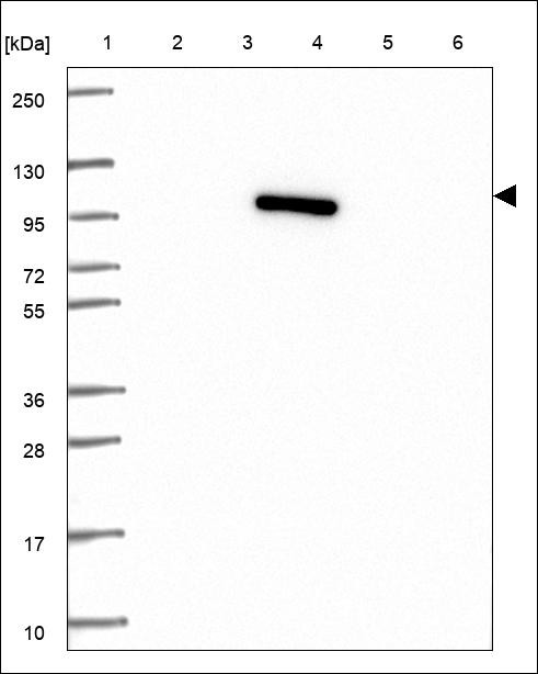 Lane 1: Marker [kDa] 250,130,95,72,55,36,28,17,10 Lane 2: RT4 Lane 3: U-251 MG Lane 4: Human Plasma Lane 5: Liver Lane 6: Tonsil