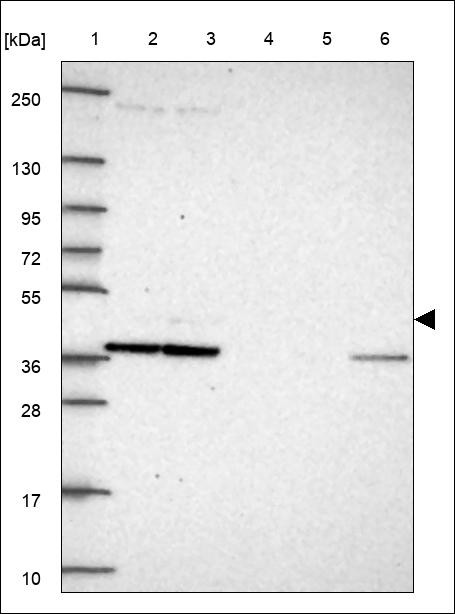 Lane 1: Marker [kDa] 250,130,95,72,55,36,28,17,10 Lane 2: RT4 Lane 3: U-251 MG Lane 4: Human Plasma Lane 5: Liver Lane 6: Tonsil