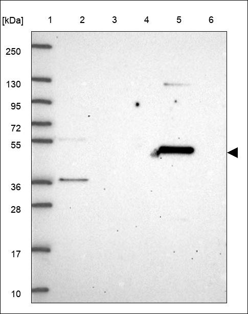 Lane 1: Marker [kDa] 250,130,95,72,55,36,28,17,10 Lane 2: RT4 Lane 3: U-251 MG Lane 4: Human Plasma Lane 5: Liver Lane 6: Tonsil
