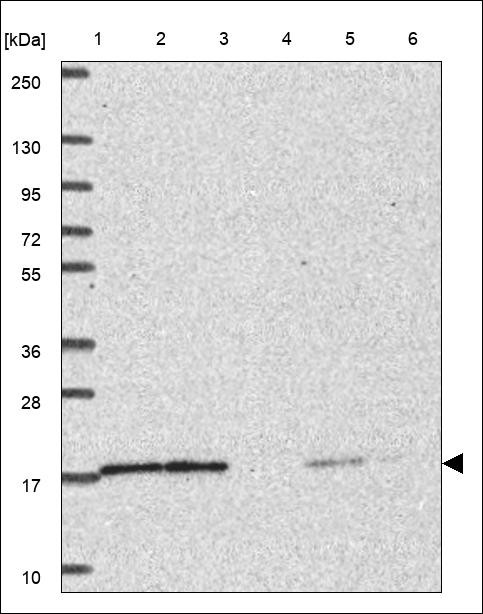 Lane 1: Marker [kDa] 250,130,95,72,55,36,28,17,10 Lane 2: RT4 Lane 3: U-251 MG Lane 4: Human Plasma Lane 5: Liver Lane 6: Tonsil