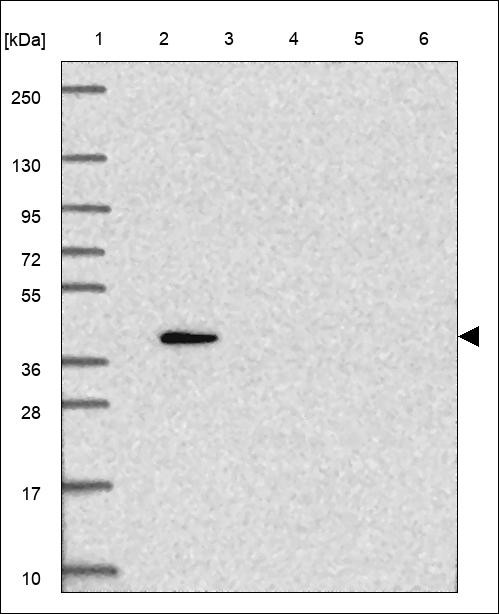 Lane 1: Marker [kDa] 250,130,95,72,55,36,28,17,10 Lane 2: RT4 Lane 3: U-251 MG Lane 4: Human Plasma Lane 5: Liver Lane 6: Tonsil