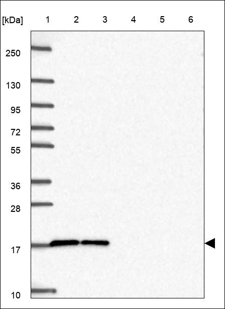 Lane 1: Marker [kDa] 250,130,95,72,55,36,28,17,10 Lane 2: RT4 Lane 3: U-251 MG Lane 4: Human Plasma Lane 5: Liver Lane 6: Tonsil