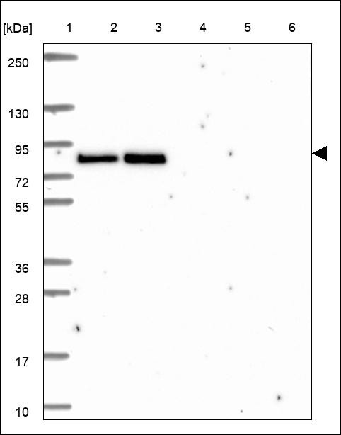 Lane 1: Marker [kDa] 250,130,95,72,55,36,28,17,10 Lane 2: RT4 Lane 3: U-251 MG Lane 4: Human Plasma Lane 5: Liver Lane 6: Tonsil