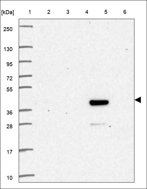 Lane 1: Marker [kDa] 250,130,95,72,55,36,28,17,10 Lane 2: RT4 Lane 3: U-251 MG Lane 4: Human Plasma Lane 5: Liver Lane 6: Tonsil
