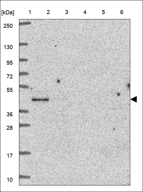 Lane 1: Marker [kDa] 250,130,95,72,55,36,28,17,10 Lane 2: RT4 Lane 3: U-251 MG Lane 4: Human Plasma Lane 5: Liver Lane 6: Tonsil