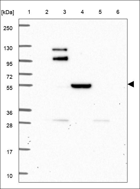 Lane 1: Marker [kDa] 250,130,95,72,55,36,28,17,10 Lane 2: RT4 Lane 3: U-251 MG Lane 4: Human Plasma Lane 5: Liver Lane 6: Tonsil