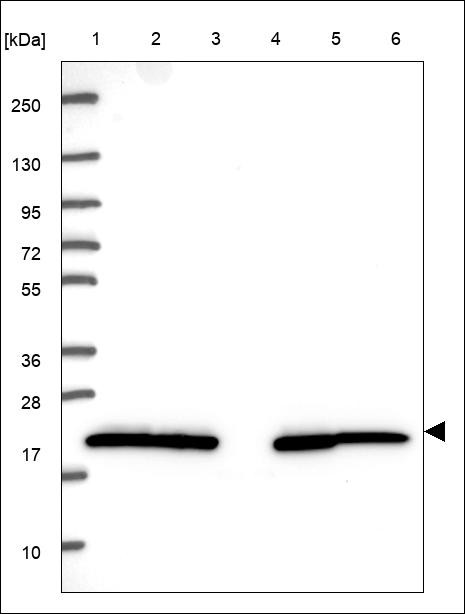Lane 1: Marker [kDa] 250,130,95,72,55,36,28,17,10 Lane 2: RT4 Lane 3: U-251 MG Lane 4: Human Plasma Lane 5: Liver Lane 6: Tonsil
