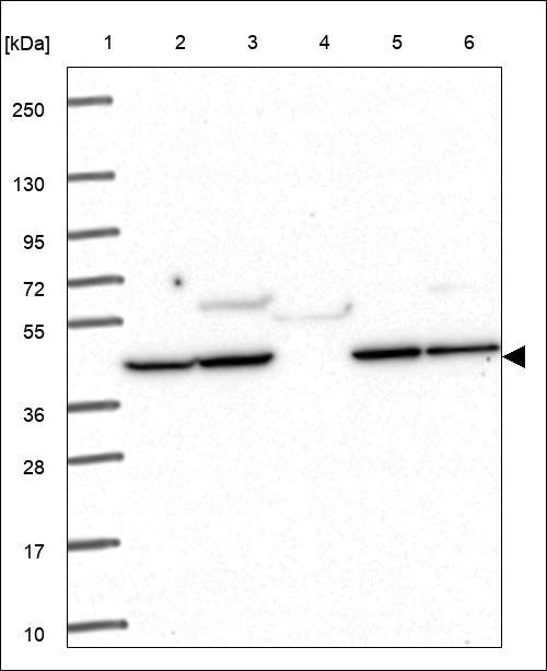 Lane 1: Marker [kDa] 250,130,95,72,55,36,28,17,10 Lane 2: RT4 Lane 3: U-251 MG Lane 4: Human Plasma Lane 5: Liver Lane 6: Tonsil
