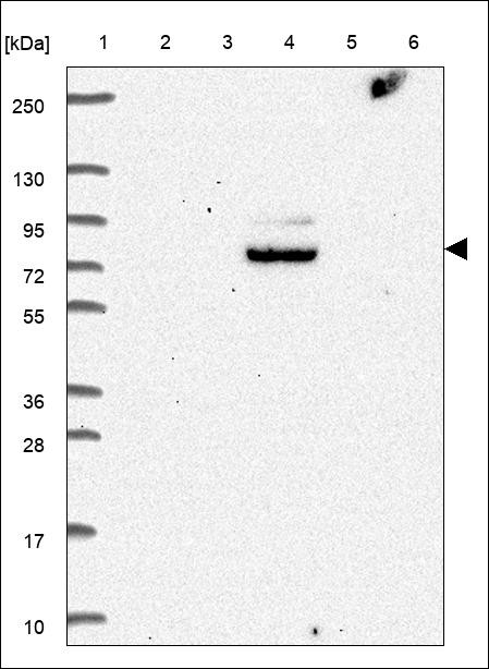 Lane 1: Marker [kDa] 250,130,95,72,55,36,28,17,10 Lane 2: RT4 Lane 3: U-251 MG Lane 4: Human Plasma Lane 5: Liver Lane 6: Tonsil
