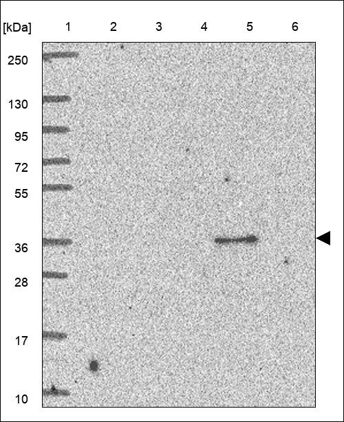 Lane 1: Marker [kDa] 250,130,95,72,55,36,28,17,10 Lane 2: RT4 Lane 3: U-251 MG Lane 4: Human Plasma Lane 5: Liver Lane 6: Tonsil