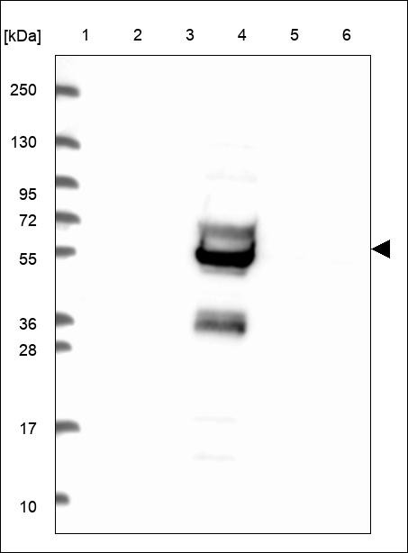 Lane 1: Marker [kDa] 250,130,95,72,55,36,28,17,10 Lane 2: RT4 Lane 3: U-251 MG Lane 4: Human Plasma Lane 5: Liver Lane 6: Tonsil