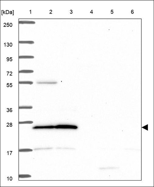 Lane 1: Marker [kDa] 250,130,95,72,55,36,28,17,10 Lane 2: RT4 Lane 3: U-251 MG Lane 4: Human Plasma Lane 5: Liver Lane 6: Tonsil