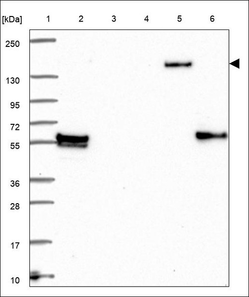 Lane 1: Marker [kDa] 250,130,95,72,55,36,28,17,10 Lane 2: RT4 Lane 3: U-251 MG Lane 4: Human Plasma Lane 5: Liver Lane 6: Tonsil