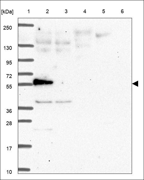 Lane 1: Marker [kDa] 250,130,95,72,55,36,28,17,10 Lane 2: RT4 Lane 3: U-251 MG Lane 4: Human Plasma Lane 5: Liver Lane 6: Tonsil