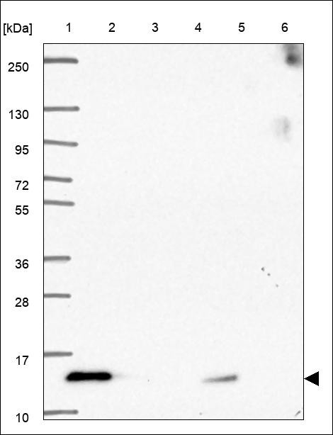 Lane 1: Marker [kDa] 250,130,95,72,55,36,28,17,10 Lane 2: RT4 Lane 3: U-251 MG Lane 4: Human Plasma Lane 5: Liver Lane 6: Tonsil