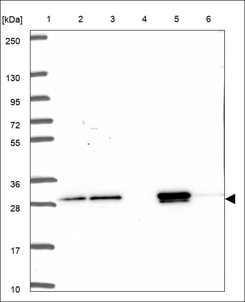 Lane 1: Marker [kDa] 250,130,95,72,55,36,28,17,10 Lane 2: RT4 Lane 3: U-251 MG Lane 4: Human Plasma Lane 5: Liver Lane 6: Tonsil