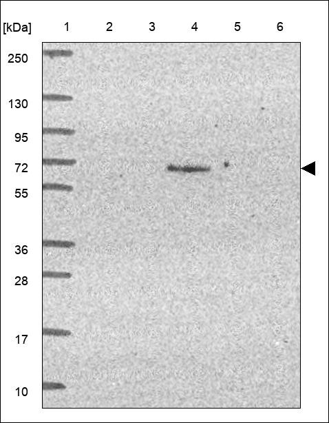 Lane 1: Marker [kDa] 250,130,95,72,55,36,28,17,10 Lane 2: RT4 Lane 3: U-251 MG Lane 4: Human Plasma Lane 5: Liver Lane 6: Tonsil