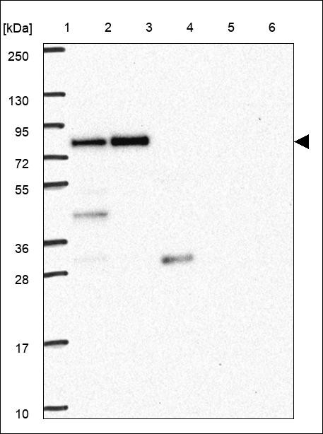 Lane 1: Marker [kDa] 250,130,95,72,55,36,28,17,10 Lane 2: RT4 Lane 3: U-251 MG Lane 4: Human Plasma Lane 5: Liver Lane 6: Tonsil