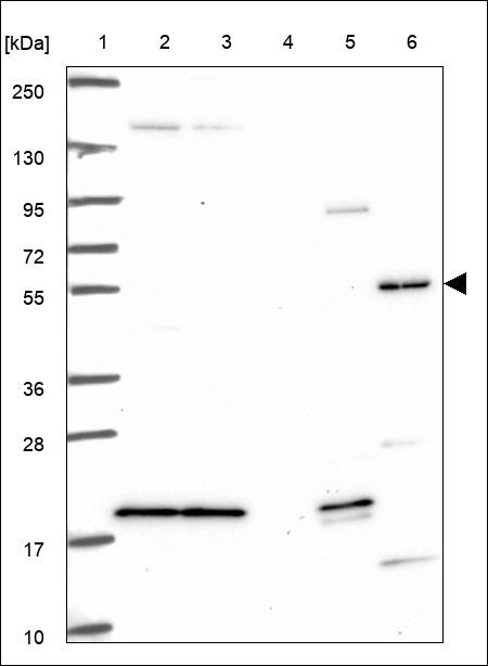 Lane 1: Marker [kDa] 250,130,95,72,55,36,28,17,10 Lane 2: RT4 Lane 3: U-251 MG Lane 4: Human Plasma Lane 5: Liver Lane 6: Tonsil