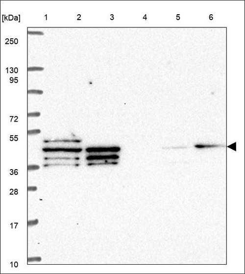 Lane 1: Marker [kDa] 250,130,95,72,55,36,28,17,10 Lane 2: RT4 Lane 3: U-251 MG Lane 4: Human Plasma Lane 5: Liver Lane 6: Tonsil