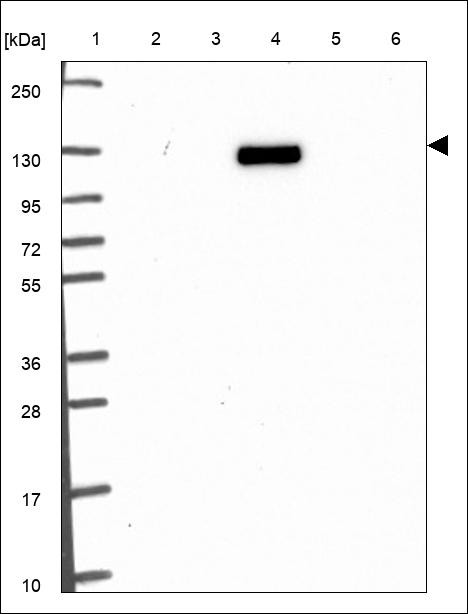 Lane 1: Marker [kDa] 250,130,95,72,55,36,28,17,10 Lane 2: RT4 Lane 3: U-251 MG Lane 4: Human Plasma Lane 5: Liver Lane 6: Tonsil