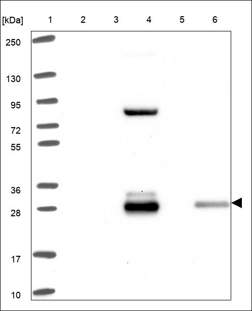 Lane 1: Marker [kDa] 250,130,95,72,55,36,28,17,10 Lane 2: RT4 Lane 3: U-251 MG Lane 4: Human Plasma Lane 5: Liver Lane 6: Tonsil