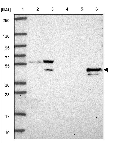 Lane 1: Marker [kDa] 250,130,95,72,55,36,28,17,10 Lane 2: RT4 Lane 3: U-251 MG Lane 4: Human Plasma Lane 5: Liver Lane 6: Tonsil